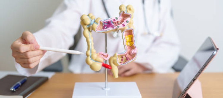 Beat Diverticulitis: Your Essential Guide to Managing Digestive Health After 55+