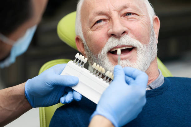 6 Ways Teeth Whitening Can Brighten Your Golden Years - Spark Joy with a Dazzling Smile